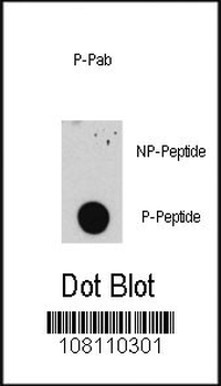 Phospho-E2F1(S332) Antibody
