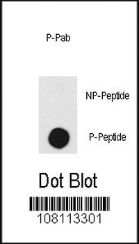 Phospho-DNA-PK(T2609) Antibody