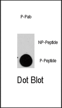 Phospho-TSC2(S1798) Antibody