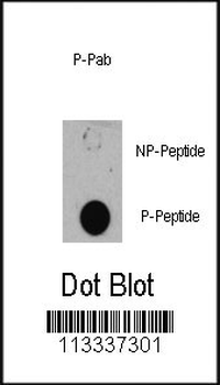 Phospho-TSC1(S505) Antibody