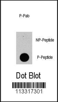 Phospho-PIK3CD(Y524) Antibody