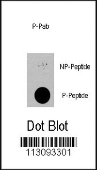 Phospho-PDPK1(S396) Antibody