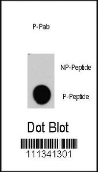 Phospho-RAF1(Y340) Antibody