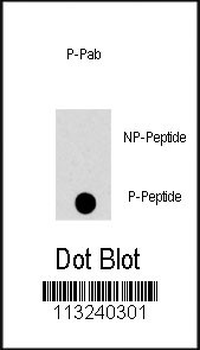 Phospho-MAPK8(T183) Antibody