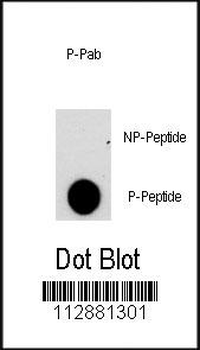 Phospho-NFATC2(S330) Antibody