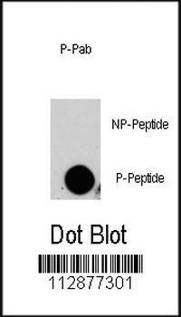 Phospho-MAP4K4(S629) Antibody