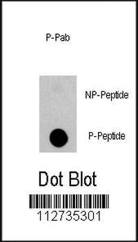 Phospho-EGFR(S1070) Antibody
