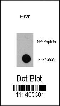 Phospho-EIF4EBP1(T36) Antibody