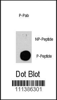Phospho-TSC2(S939) Antibody