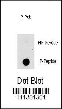Phospho-MAP3K8(T290) Antibody