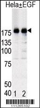 Phospho-EGFR(Y1092) Antibody