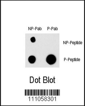 Phospho-EGFR(Y998) Antibody