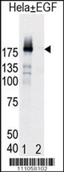 Phospho-EGFR(Y998) Antibody