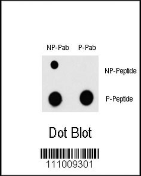 Phospho-MEF2C(T300) Antibody