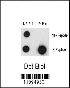 Phospho-CHUK(T23) Antibody