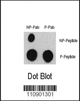 Phospho-ATF2(S322) Antibody