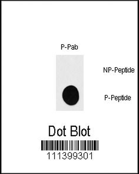Phospho-RPS6KB1(S418) Antibody