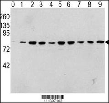 Phospho-RAF1(S338) Antibody