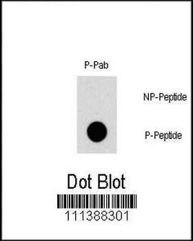 Phospho-TSC2(S1387) Antibody