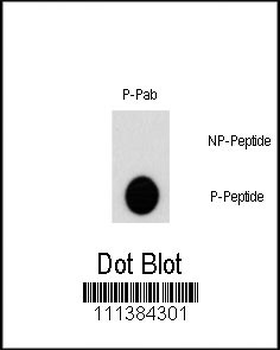 Phospho-AKT2(S474) Antibody