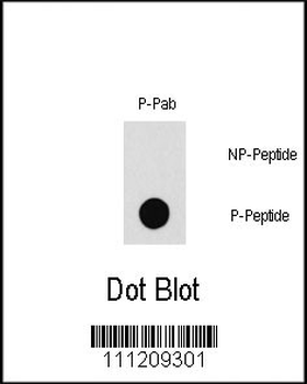 Phospho-PAK1(T212) Antibody