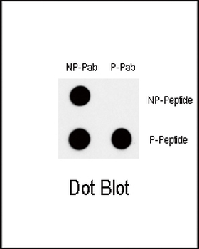 Phospho-MYC(T58) Antibody