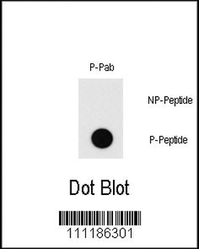 Phospho-MEF2C(T20) Antibody