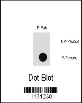 Phospho-MAP3K7(T187) Antibody