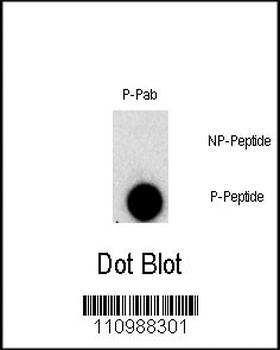 Phospho-FGFR1(Y307) Antibody