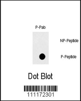 Phospho-FAS(Y291) Antibody