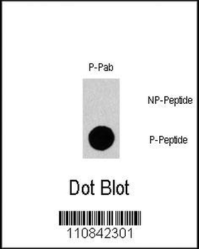 Phospho-Gab1(Y659) Antibody