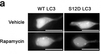Phospho-LC3C(S12) Antibody