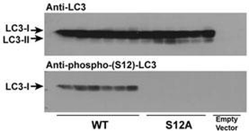 Phospho-LC3C(S12) Antibody