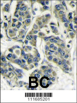 S6K (RPS6KB1) Antibody (Center)