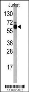 S6K (RPS6KB1) Antibody (Center)
