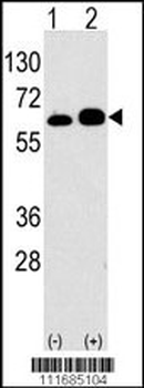 S6K (RPS6KB1) Antibody (Center)