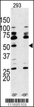 S6K (RPS6KB1) Antibody (Center)