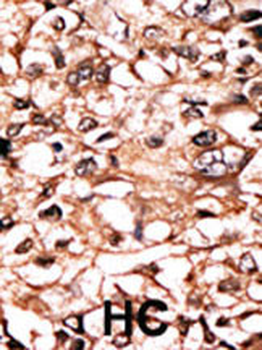 Phospho-TNFR(S274) Antibody