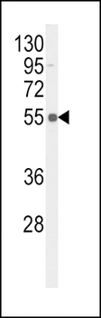Phospho-TNFR(S274) Antibody
