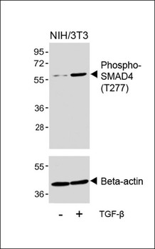 Phospho-SMAD4(T277) Antibody
