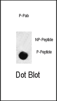 Phospho-SMAD3(S208) Antibody