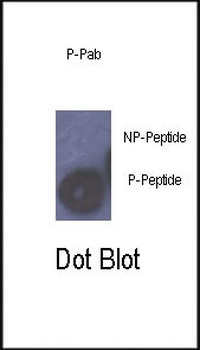 Phospho-Rb(S780) Antibody