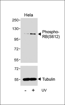 Phospho-RB(S612) Antibody