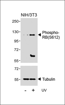 Phospho-RB(S612) Antibody