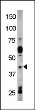 Phospho-RAD9(Y28) Antibody