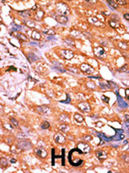 Phospho-PDGFR-Y579 Antibody