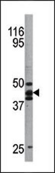 Phospho-p53(S20) Antibody
