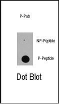 Phospho-EP300(S89) Antibody