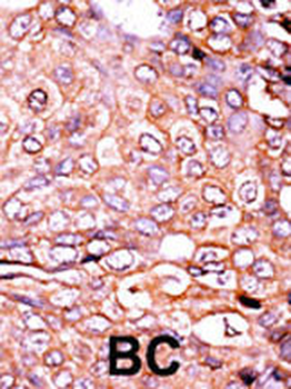 Phospho-EP300(S89) Antibody