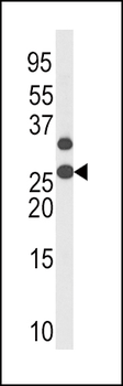 Phospho-p27Kip1(T187) Antibody